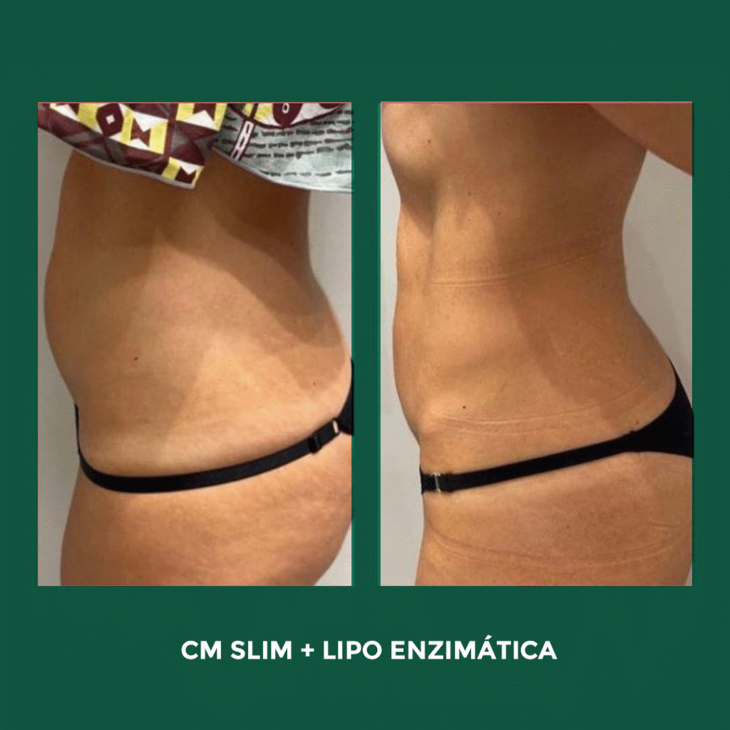 CS-SLIM-+-LIPO-ENZIMATIC