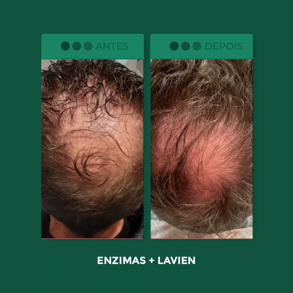 Enzimas-+-Liveen