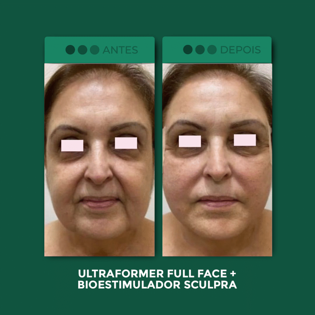 UF-Full-Face-3