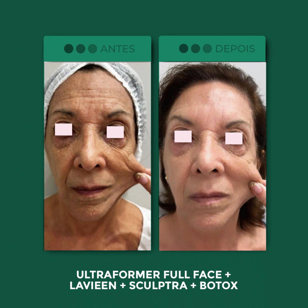 UF-Full-Face-4