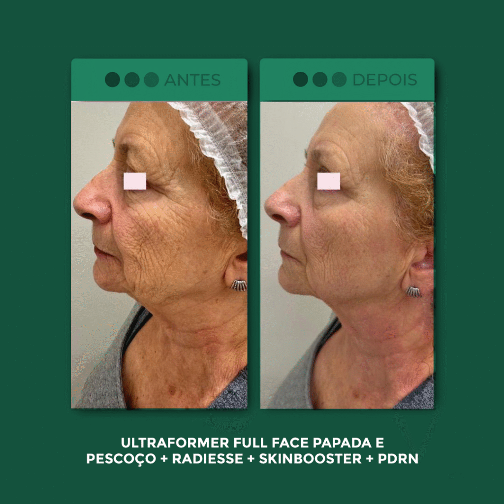 UF-Full-Face2