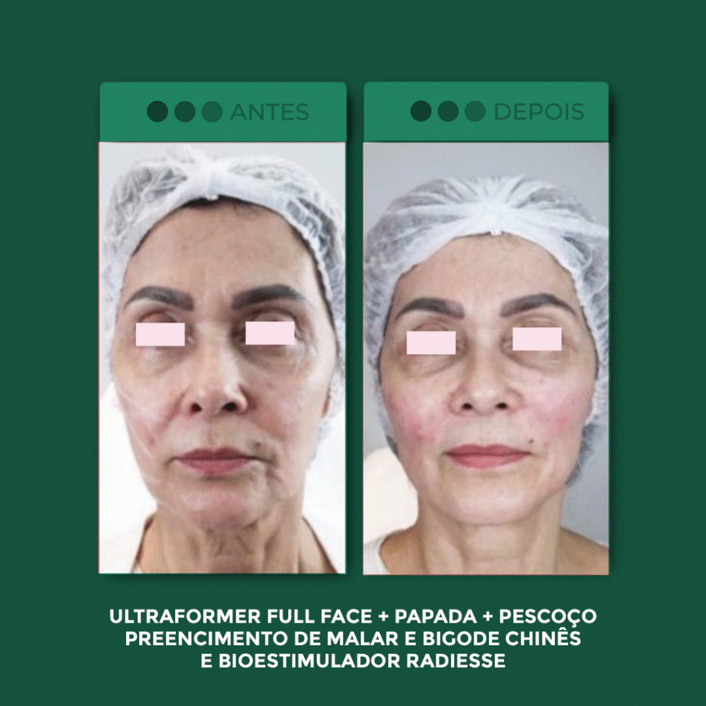 UF-Fullface-+-papada